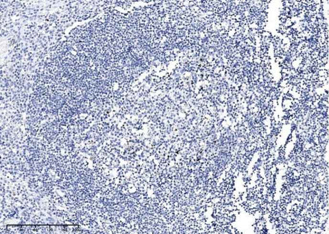 Anti-Human PARP1 Antibody [A883] - ABMIUM