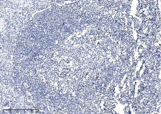 Anti-Human PARP1 Antibody [A883] - ABMIUM