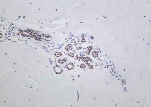 Anti-Human/Mouse/Rat Histone H2A.Z Antibody [B1025] - ABMIUM