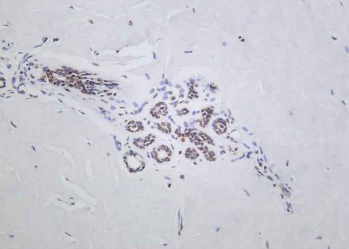 Anti-Human/Mouse/Rat Histone H2A.Z Antibody [B1025]