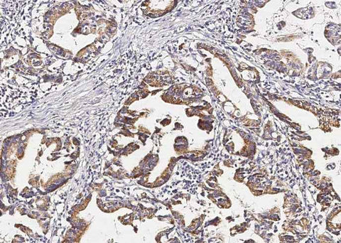 Anti-Human PGA4 Antibody [B358] - ABMIUM