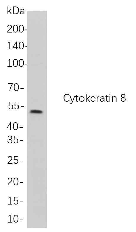 Anti-Human/Mouse/Rat Cytokeratin 8 Antibody [B715] - ABMIUM