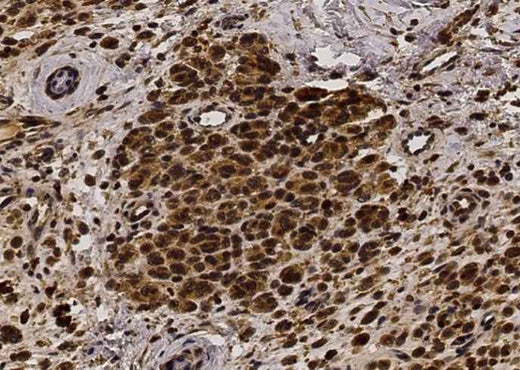 Anti-Human FGF2 Antibody [A1211] - ABMIUM
