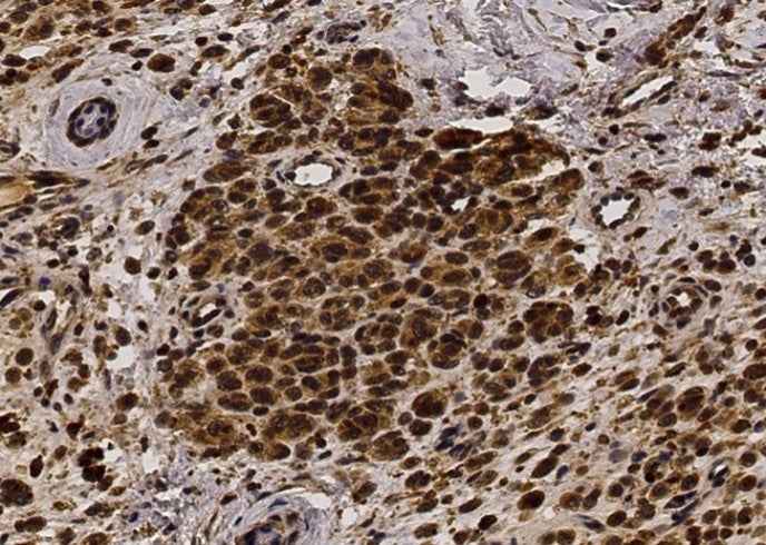 Anti-Human FGF2 Antibody [A1211] - ABMIUM