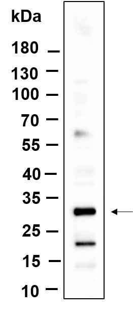 Anti-Human/Mouse/Rat KCTD21 Antibody [B960] - ABMIUM