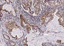Anti-Human Tie1 Antibody [A903] - ABMIUM