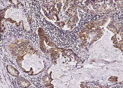Anti-Human Tie1 Antibody [A903] - ABMIUM
