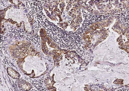Anti-Human Tie1 Antibody [A903] - ABMIUM