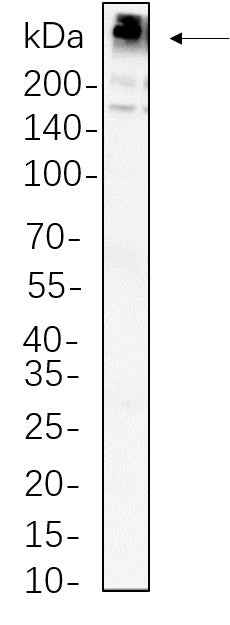 Anti-Human/Mouse/Rat Fatty Acid Synthase Antibody [B778] - ABMIUM