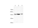 Anti-Human/Rat TNF RI/TNFRSF1A Antibody - ABMIUM