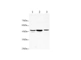 Anti-Human/Rat TNF RI/TNFRSF1A Antibody - ABMIUM