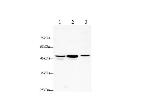 Anti-Human/Rat TNF RI/TNFRSF1A Antibody - ABMIUM