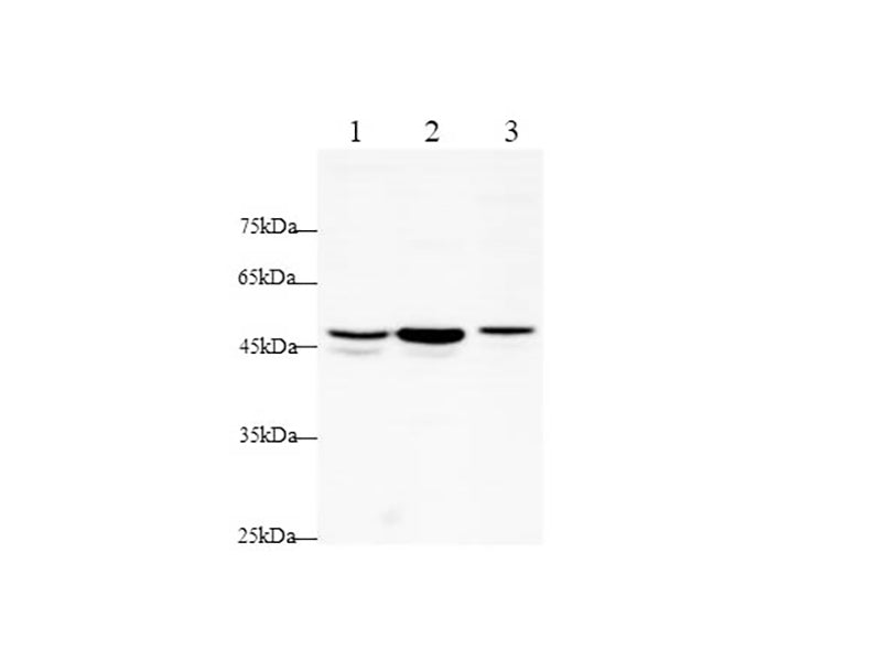 Anti-Human/Rat TNF RI/TNFRSF1A Antibody - ABMIUM