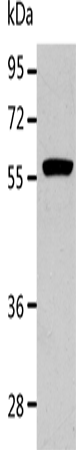 Anti-Human/Mouse/Rat ALDH1A2 Antibody - ABMIUM
