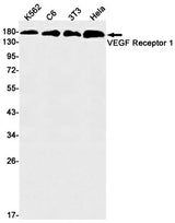 Western blot detection of VEGF Receptor 1 in K562,C6,3T3,Hela cell lysates using VEGF Receptor 1 Rabbit mAb(1:1000 diluted).Predicted band size:151kDa.Observed band size:180kDa.