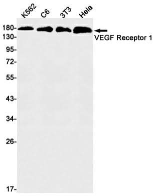 Western blot detection of VEGF Receptor 1 in K562,C6,3T3,Hela cell lysates using VEGF Receptor 1 Rabbit mAb(1:1000 diluted).Predicted band size:151kDa.Observed band size:180kDa.