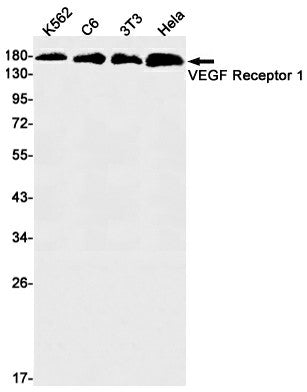 Western blot detection of VEGF Receptor 1 in K562,C6,3T3,Hela cell lysates using VEGF Receptor 1 Rabbit mAb(1:1000 diluted).Predicted band size:151kDa.Observed band size:180kDa.