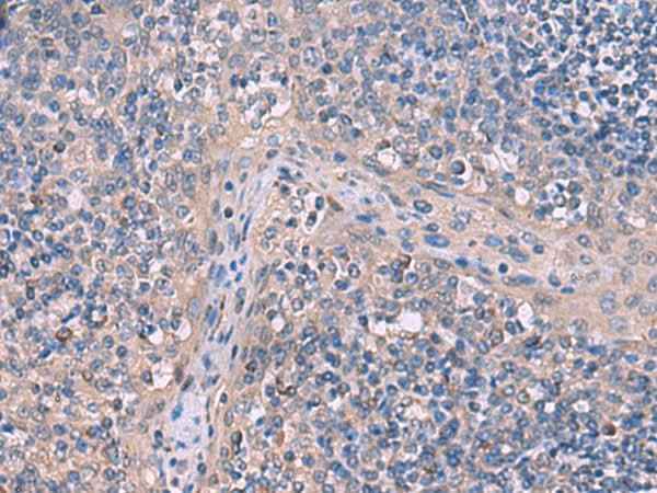 Anti-Human/Mouse/Rat ITPR2 Antibody