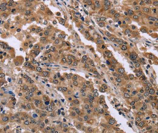 Anti-Human/Mouse FAM3B Antibody