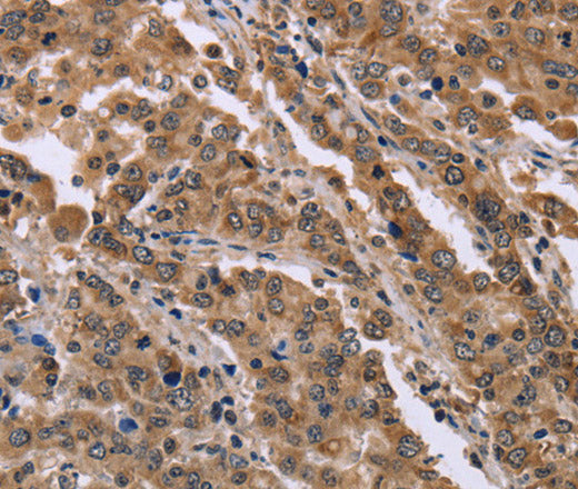 Anti-Human/Mouse FAM3B Antibody - ABMIUM