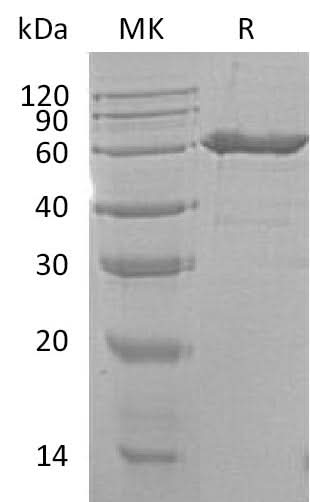 Recombinant Mouse CD73/NT5E Protein (His Tag) - ABMIUM