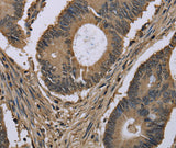 Anti-Human MYO18B Antibody - ABMIUM