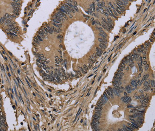 Anti-Human MYO18B Antibody - ABMIUM