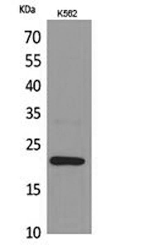 Western Blot analysis of K562 cells using IL6 Polyclonal Antibody at dilution of 1:1000.