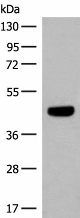 Western blot analysis of HT29 cell lysate using GNAT1 Polyclonal Antibody at dilution of 1:250