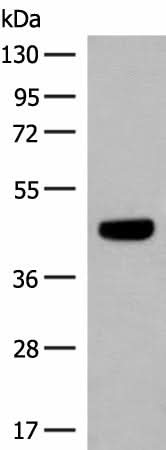 Western blot analysis of HT29 cell lysate using GNAT1 Polyclonal Antibody at dilution of 1:250