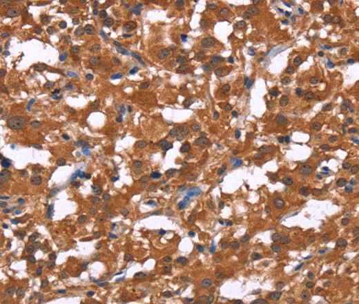 Anti-Human HLTF Antibody