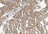 Anti-Human CIB2 Antibody [B352]