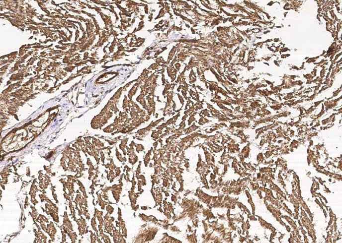 Anti-Human CIB2 Antibody [B352] - ABMIUM