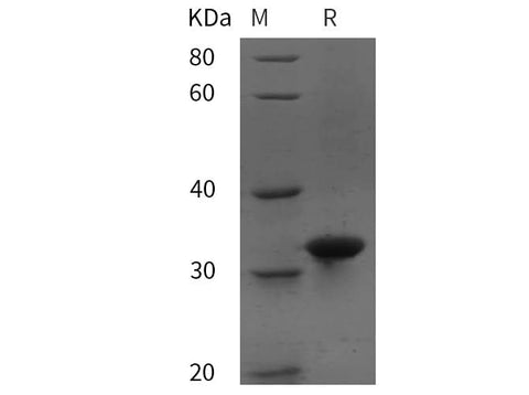 SDS-PAGE analysis of Mouse MME/CD10/Neprilysin proteins, 2 μg/lane of Recombinant Mouse MME/CD10/Neprilysin proteins was resolved with SDS-PAGE under reducing conditions, showing bands at 32 kDa.