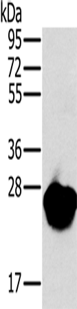 Anti-Human/Mouse/Rat MYL3 Antibody - ABMIUM