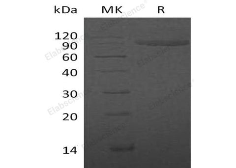 Recombinant Human IL1R2/CD121b Protein (Fc Tag) - ABMIUM