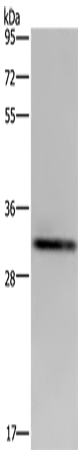 Anti-Human ICAM4 Antibody - ABMIUM