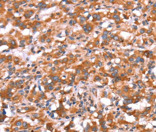 Anti-Human/Mouse/Rat GAS8 Antibody - ABMIUM