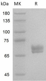 Recombinant Human Wnt3a/Wnt-3a - ABMIUM