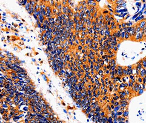 Anti-Human IL18BP Antibody