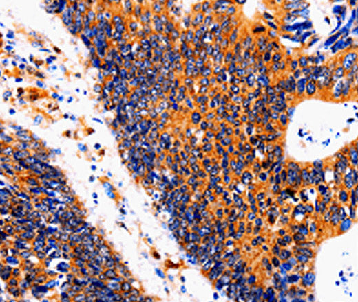 Anti-Human IL18BP Antibody - ABMIUM