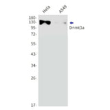 Western blot detection of Dnmt3a in Hela,A549 cell lysates using Dnmt3a Rabbit mAb(1:1000 diluted).Predicted band size:102kDa.Observed band size:130kDa.