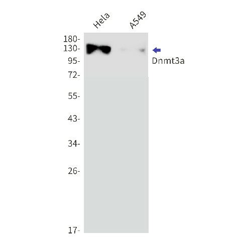 Western blot detection of Dnmt3a in Hela,A549 cell lysates using Dnmt3a Rabbit mAb(1:1000 diluted).Predicted band size:102kDa.Observed band size:130kDa.