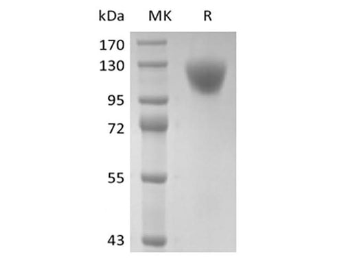 Recombinant Human CD45RA (C-6His) - ABMIUM