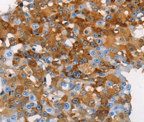 Anti-Human MUC5B Antibody - ABMIUM