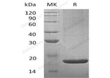 Recombinant Mouse Lithostathine-2/REG2 Protein (His Tag) - ABMIUM