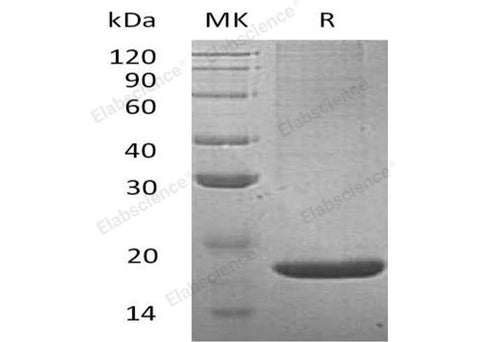 Recombinant Mouse Lithostathine-2/REG2 Protein (His Tag) - ABMIUM