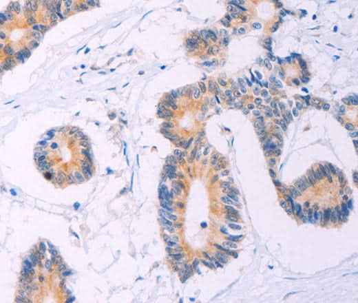 Anti-Human/Mouse/Rat ADCY5 Antibody