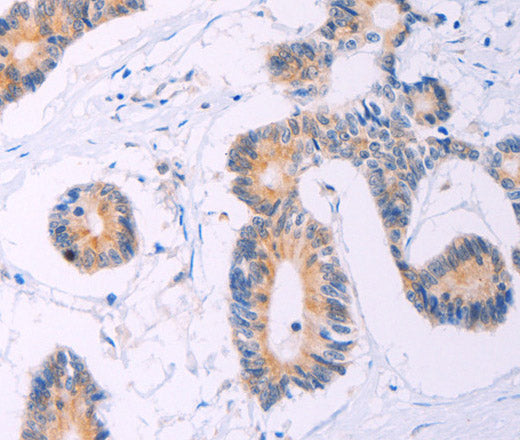 Anti-Human/Mouse/Rat ADCY5 Antibody - ABMIUM
