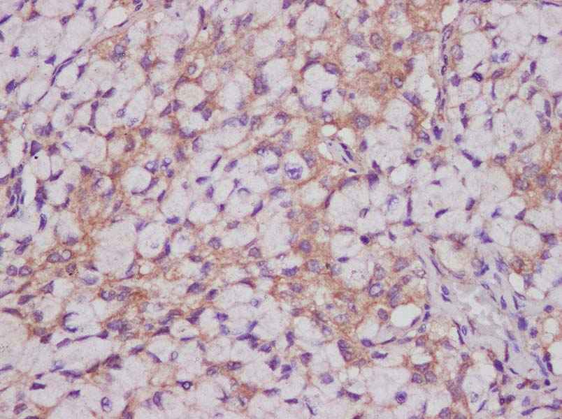 Anti-Human CEACAM-1/CD66a Antibody - ABMIUM
